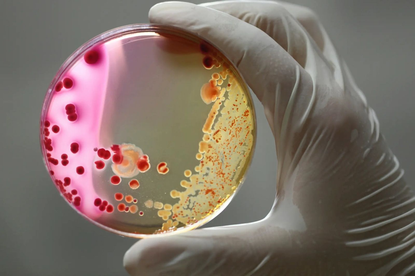 Serratia marcescens bacteria rezistenta in ATI