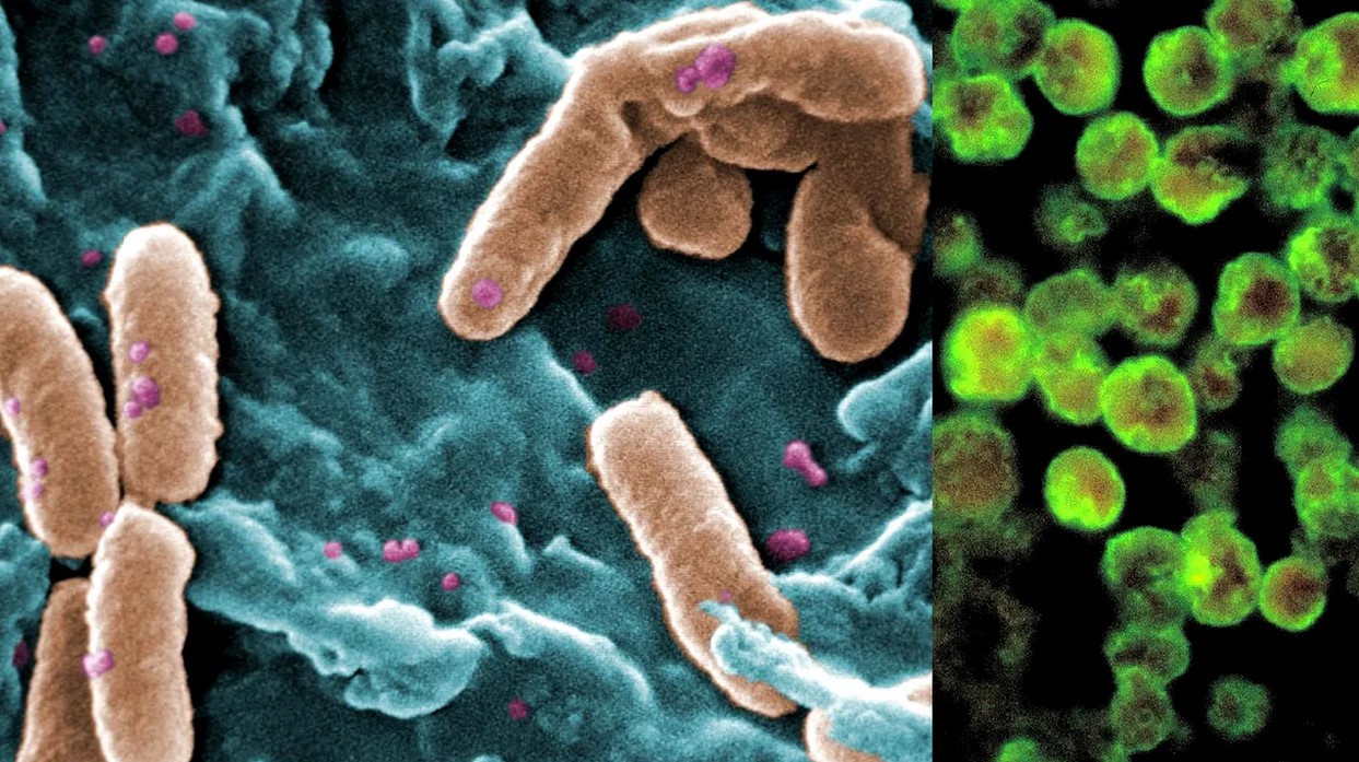 epidemie de holera in nigeria 58 de decese 250 infectati