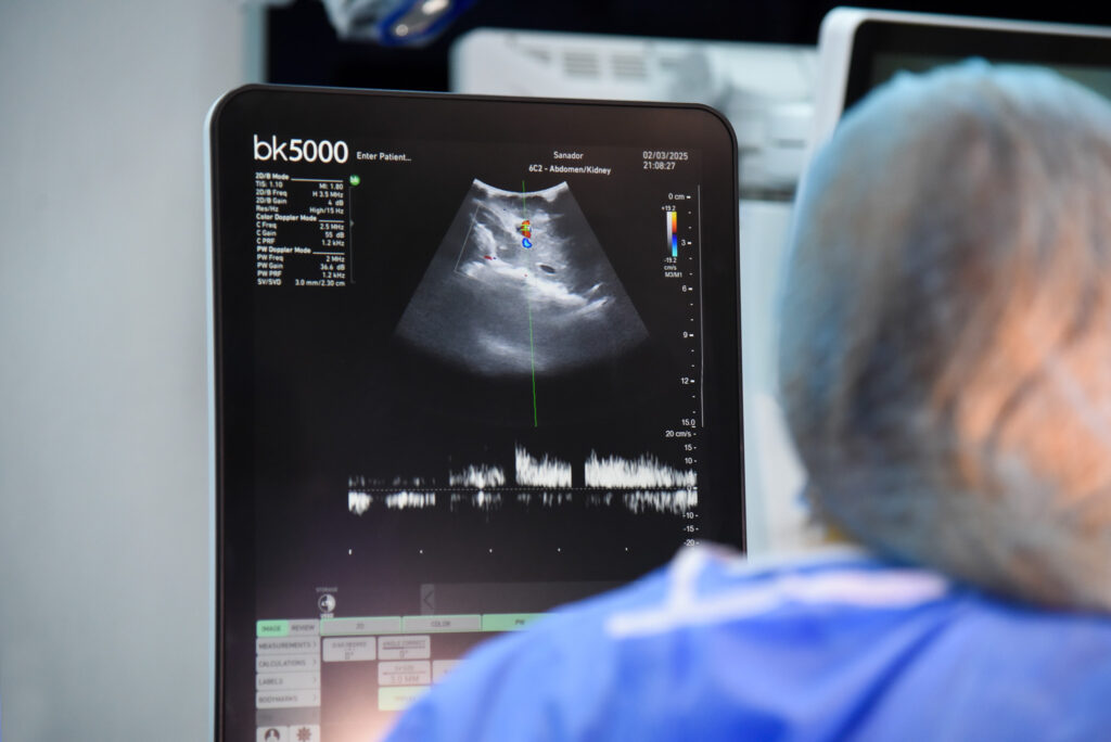 84 de donatori si aproape 300 de transplanturi