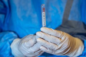 Presa maghiare preocupata de situatia din Romania Hantavirusul a ajuns la granita