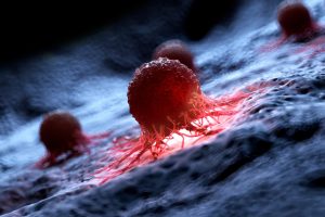 Universitatea Washington din SUA anunta dezvoltarea unui vaccin personalizat pentru cancerul cerebral