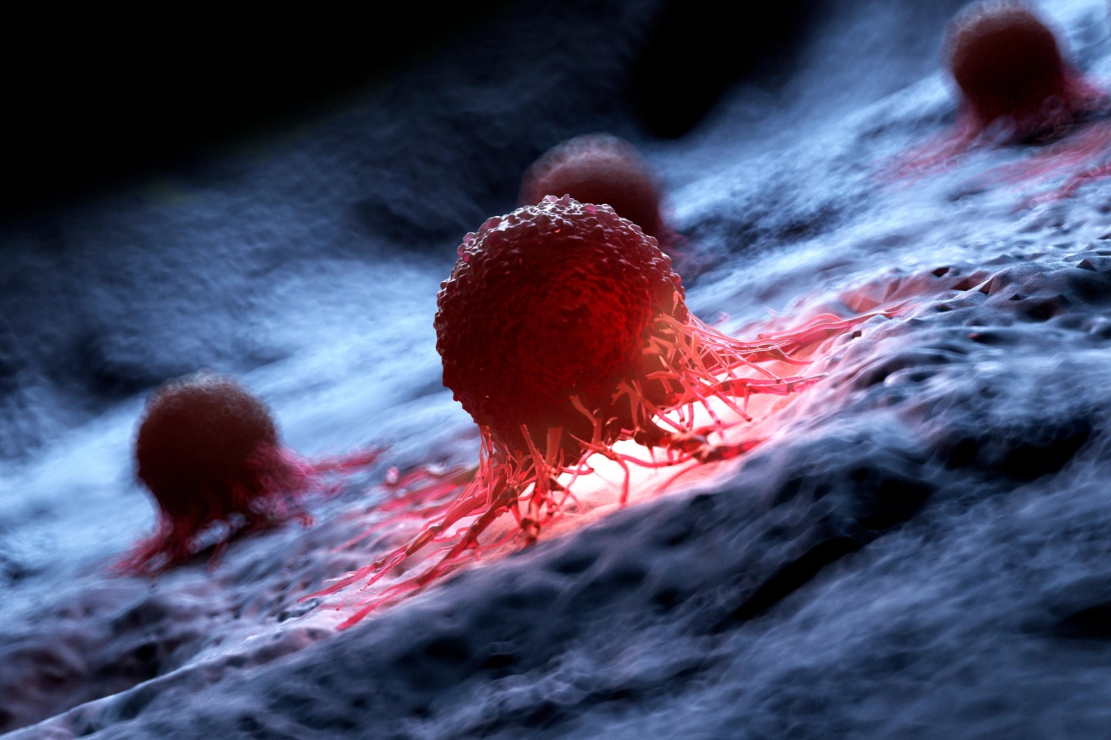 Universitatea Washington din SUA anunta dezvoltarea unui vaccin personalizat pentru cancerul cerebral