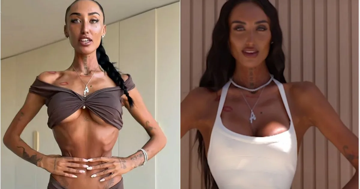 Fracturarea coastelor, noul trend periculos pentru talia de viespe