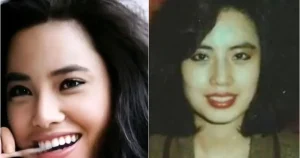 Modelul Hang Mioku, desfigurată de operații estetice, și-a injectat ulei de gătit în față